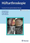 Hüftarthroskopie (eBook, PDF)