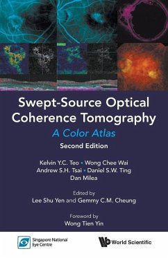 Swept-Source Optical Coherence Tomography - Teo, Kelvin Y C; Wong, Chee Wai; Tsai, Andrew S H