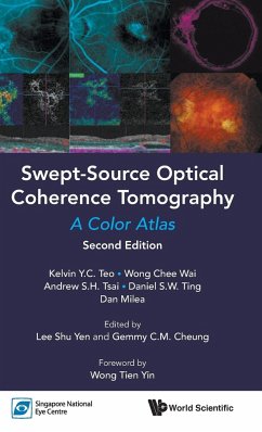 Swept-Source Optical Coherence Tomography: A Color Atlas (Second Edition) - Teo, Kelvin Yi Chong; Wong, Chee Wai; Tsai, Andrew Shih Hsiang; Ting, Daniel Shu Wei; Milea, Dan