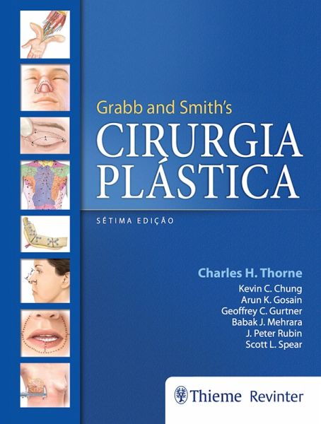 Grabb and Smith's Cirurgia Plástica (eBook, ePUB) Grabb and Smith's Cirurgia Plástica (eBook, ePUB)