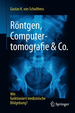 Röntgen, Computertomografie & Co. (eBook, PDF) - von Schulthess, Gustav K.