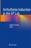 Arrhythmia Induction in the EP Lab