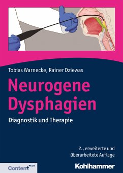 Neurogene Dysphagien (eBook, ePUB) - Warnecke, Tobias; Dziewas, Rainer