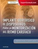 Implante quirúrgico de dispositivos para la monitorización del ritmo cardíaco - Poole, Jeanne E.; Larson, Lyle W.