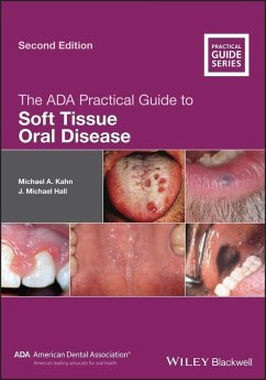 The ADA Practical Guide to Soft Tissue Oral Disease (eBook, PDF) - Kahn, Michael A.; Hall, J. Michael