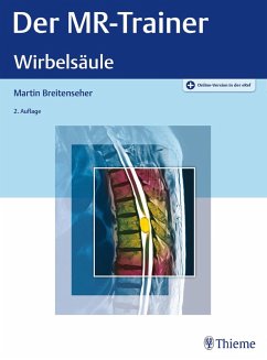 Der MR-Trainer Wirbelsäule (eBook, PDF)