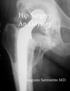 Hip Surgery - An Odyssey - Sarmiento, Augusto