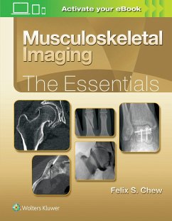 Musculoskeletal Imaging: The Essentials - Chew, Felix S.