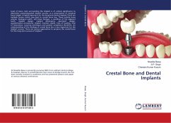 Crestal Bone and Dental Implants