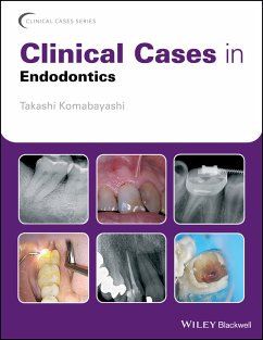 Clinical Cases in Endodontics (eBook, ePUB) - Komabayashi, Takashi