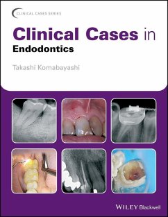 Clinical Cases in Endodontics (eBook, PDF) - Komabayashi, Takashi