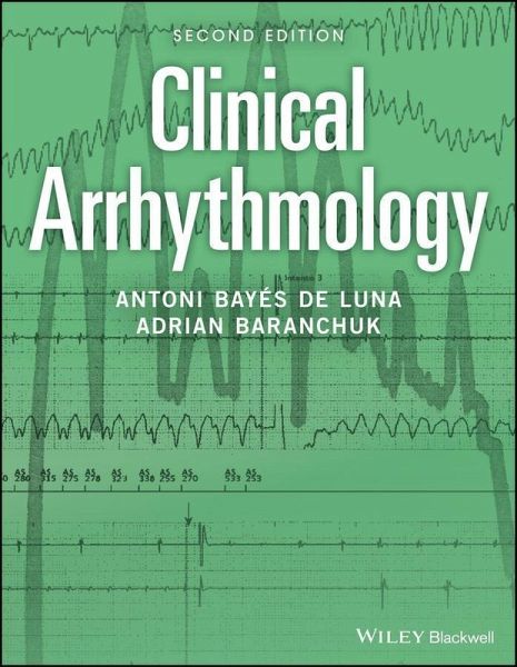 Clinical Arrhythmology (eBook, PDF) Clinical Arrhythmology (eBook, PDF)