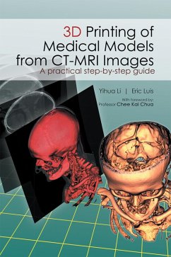 3D Printing of Medical Models from Ct-Mri Images (eBook, ePUB) - Luis, Eric; Li, Yihua