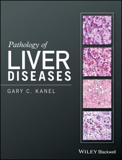 Pathology of Liver Diseases (eBook, PDF) - Kanel, Gary C.