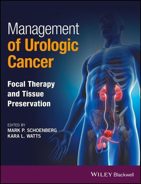 Management of Urologic Cancer (eBook, ePUB) Management of Urologic Cancer (eBook, ePUB)
