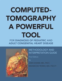 Computed-Tomography a Powerful Tool for Diagnosis of Pediatric and Adult Congenital Heart Disease (eBook, ePUB)