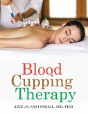 Blood Cupping Therapy (eBook, ePUB)