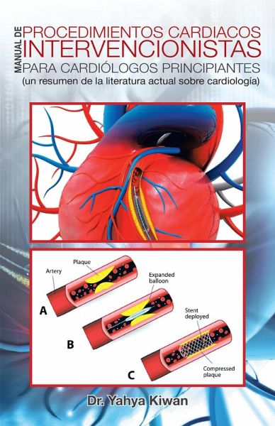 Manual De Procedimientos Cardiacos Intervencionistas Para Cardiólogos Principiantes (eBook, ePUB) Manual De Procedimientos Cardiacos Intervencionistas Para Cardiólogos Principiantes (eBook, ePUB)