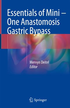 Essentials of Mini ‒ One Anastomosis Gastric Bypass (eBook, PDF)