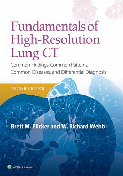 Fundamentals of High-Resolution Lung CT - Elicker, Brett M.; Webb, W. Richard