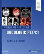 Fundamentals of Oncologic Pet/CT - Bild 1