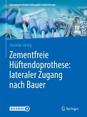 Zementfreie Hüftendoprothese: lateraler Zugang nach Bauer (eBook, PDF)