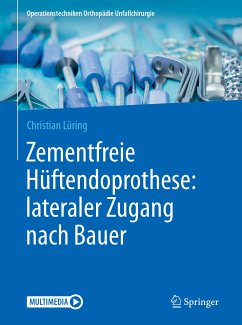 Zementfreie Hüftendoprothese: lateraler Zugang nach Bauer (eBook, PDF) - Lüring, Christian