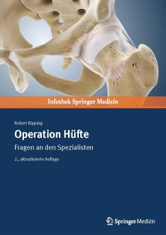 Operation Hüfte (eBook, PDF) - Kipping, Robert