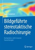 Bildgeführte stereotaktische Radiochirurgie (eBook, PDF)