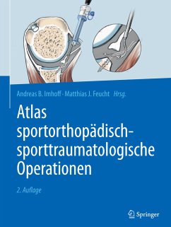 Atlas sportorthopädisch-sporttraumatologische Operationen (eBook, PDF)