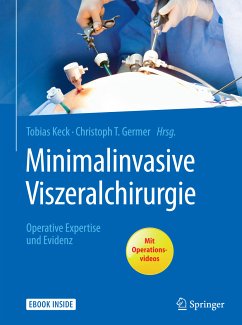 Minimalinvasive Viszeralchirurgie (eBook, PDF)