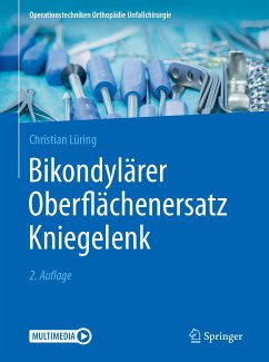 Bikondylärer Oberflächenersatz Kniegelenk (eBook, PDF) - Lüring, Christian