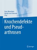 Knochendefekte und Pseudarthrosen (eBook, PDF)