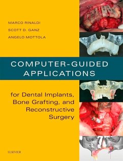 Computer-Guided Dental Implants and Reconstructive Surgery (eBook, ePUB) - Rinaldi, Marco; Ganz, Scott D; Mottola, Angelo