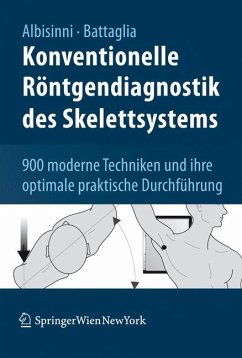Konventionelle Röntgendiagnostik des Skelettsystems (eBook, PDF) - Albisinni, Ugo; Battaglia, Milva