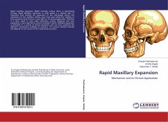 Rapid Maxillary Expansion