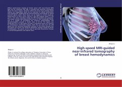 High-speed MRI-guided near-infrared tomography of breast hemodynamics