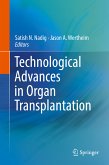 Technological Advances in Organ Transplantation (eBook, PDF)
