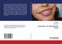Evolution of orthodontic wires