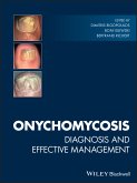 Onychomycosis (eBook, ePUB)