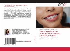 Verticalización de molares con sistema cantilever doble - Márquez Reyes, Giuliana;Oliveira, Cristina