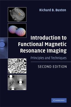 Introduction to Functional Magnetic Resonance Imaging (eBook, ePUB) - Buxton, Richard B.