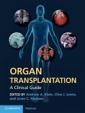 Organ Transplantation (eBook, ePUB)
