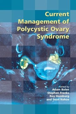 Cover Current Management of Polycystic Ovary Syndrome (eBook, ePUB)