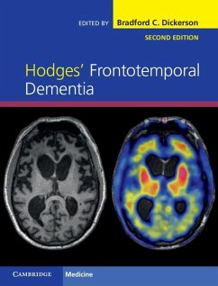 Cover Hodges' Frontotemporal Dementia (eBook, ePUB)