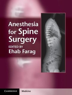 Anesthesia for Spine Surgery (eBook, ePUB)