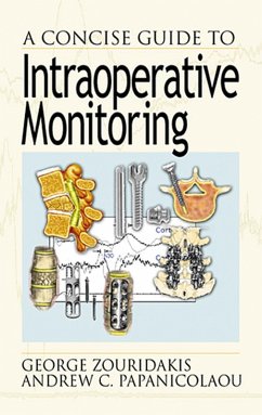 A Concise Guide to Intraoperative Monitoring (eBook, PDF) - Zouridakis, George; Papanicolaou, Andrew C.