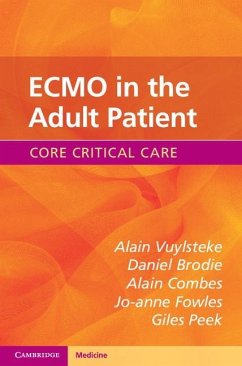 ECMO in the Adult Patient (eBook, ePUB) - Vuylsteke, Alain
