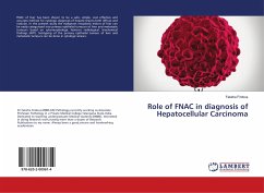 Role of FNAC in diagnosis of Hepatocellular Carcinoma