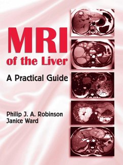 Cover MRI of the Liver (eBook, PDF)